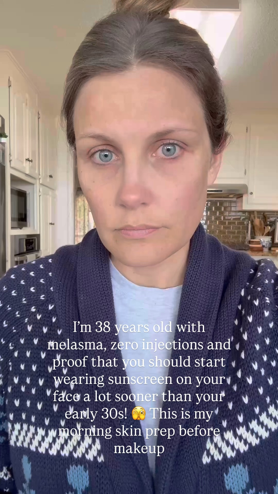 The eye cream I use is from @skinbetterscience and I cannot link it! 
You have to see a medspa or your dermatologist- and link their location before you can purchase. 

I also use the other two I linked but if you want the best out there, I love Skin Better Scienece 

#LTKmorningroutine #LTKBeauty #LTKgrwm