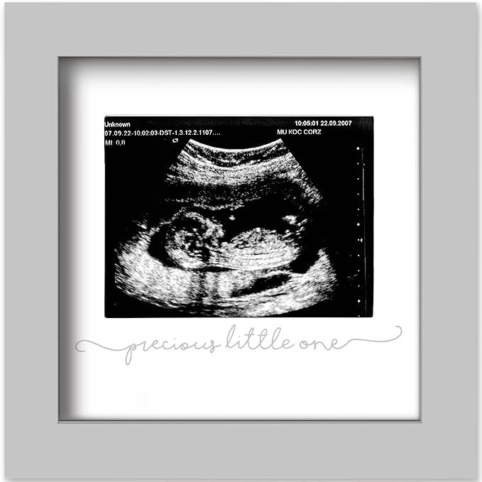 KeaBabies Baby Sonogram Picture Frame - Modern Ultrasound Frame for Mom to Be, Pregnancy Announce... | Amazon (US)