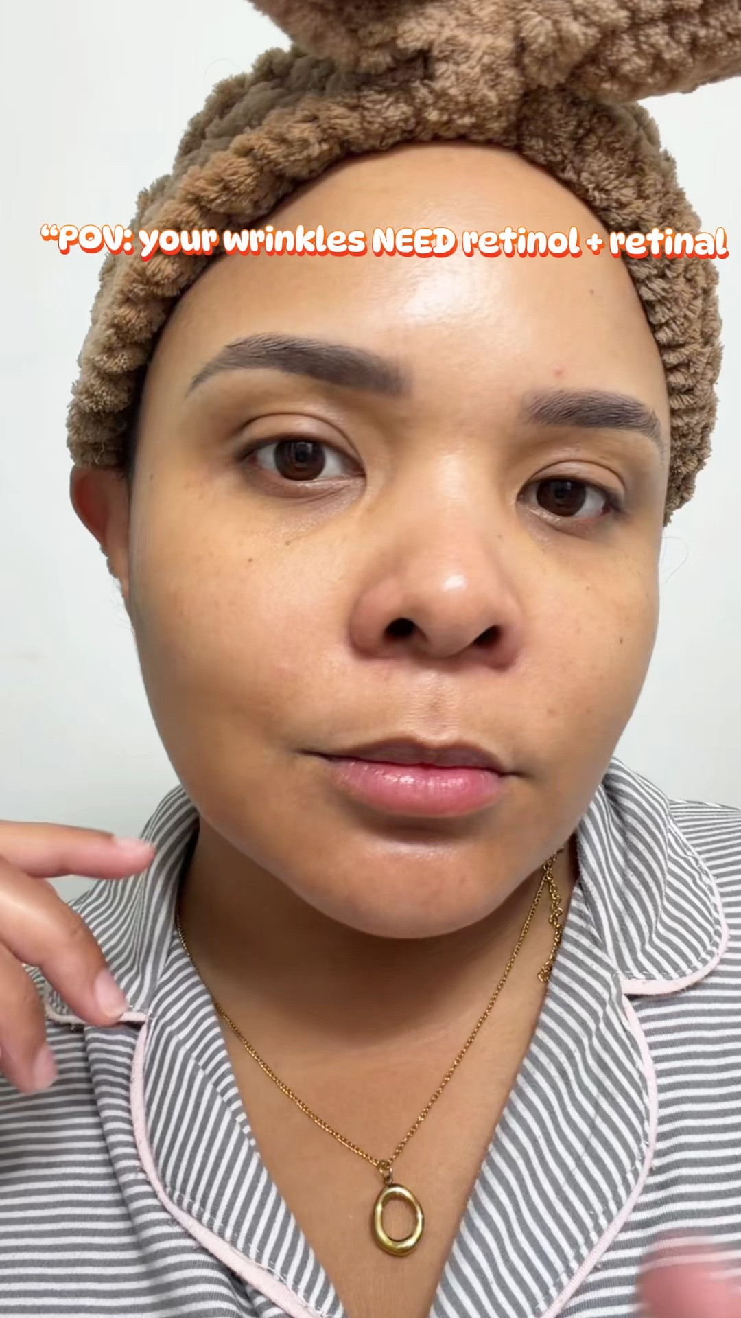 ¡Mis secretos de belleza limpia y natural! Como ya les he contado, me encanta que mi piel se
vea real y sin filtros falsos en cámara.
** Pero la
verdad es que cumplo 39 años muy pronto (ishhh! ••) y para mantener mi carita fresca, me cuido
muchísimo.
Este Purito Seoul Retinol Retinal 2000 NAD+ Serum es mi santo grial absoluto. ¿ Es potente pero tan suave. Lo uso para reafirmar y mantener la elasticidad sin irritar. Se lo juro, es el secreto detrás
de esa luminosidad natural que ven en mis videos.

#LTKOver40 #LTKselfcare
