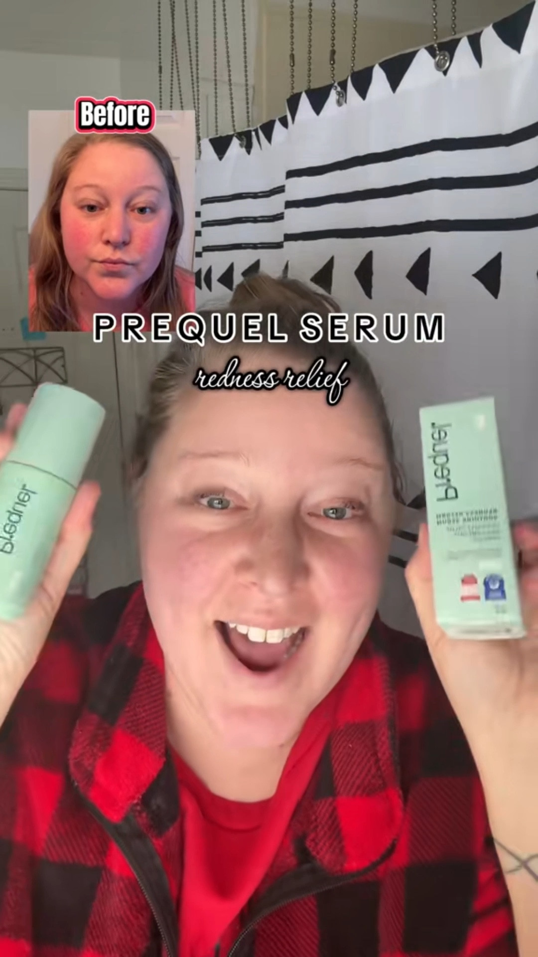 The serum that those of us with rosacea have been looking for is finally here! Check out Prequel’s Redness Reform.

#LTKBeauty #LTKmorningroutine #LTKselfcare