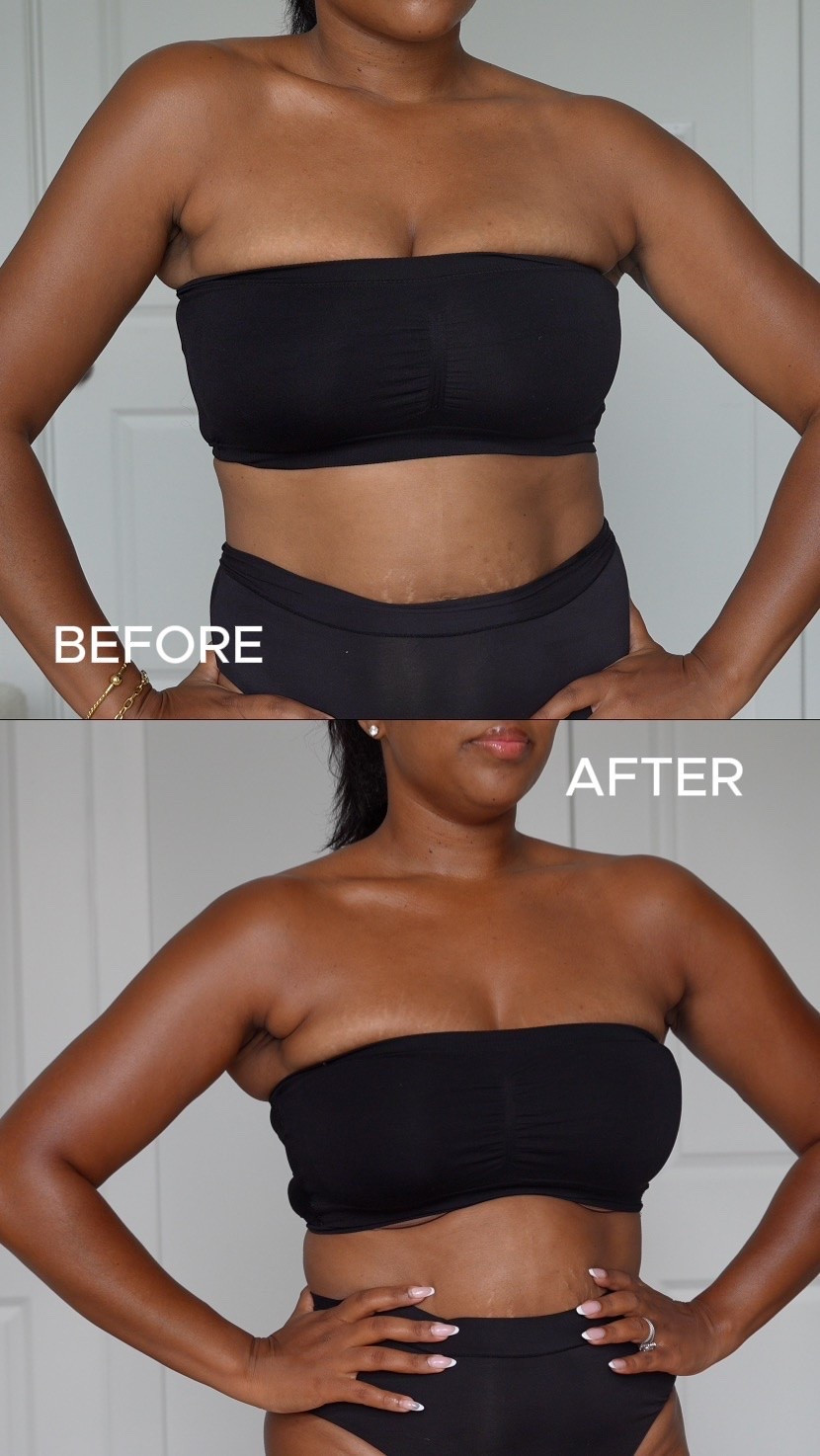 First time self tanning, obsessed!!

#LTKdayinmylife #LTKselfcare #LTKBeauty