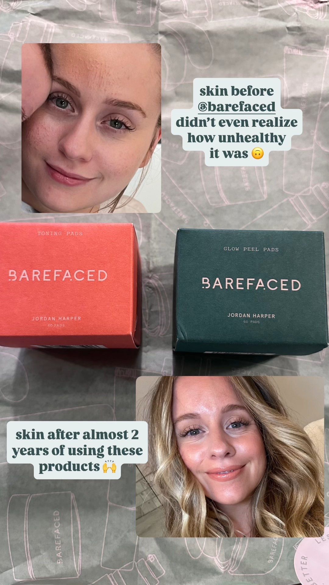 These toning pads have CHANGED my skin. Shop my fave skin care products here! 🙌👏🏼



#LTKBeauty #LTKFindsUnder100