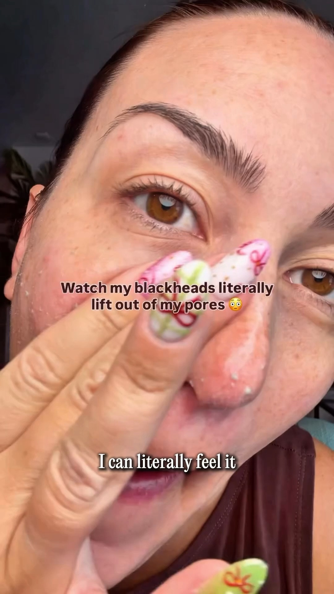 The best exfoliation to get rid of blackheads, acne & bumps!

#LTKgrwm #LTKselfcare #LTKBeauty