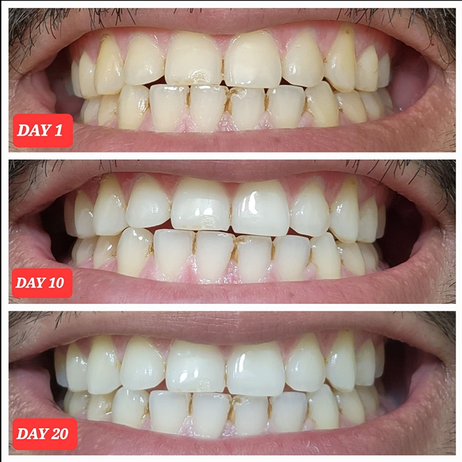 Results 🔥🔥🔥