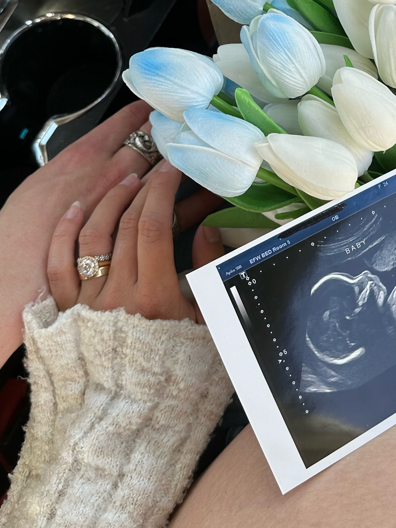 Ring stack for my swollen fingers🥰 #jewelry#ringstack#weddingband  

#LTKbaby