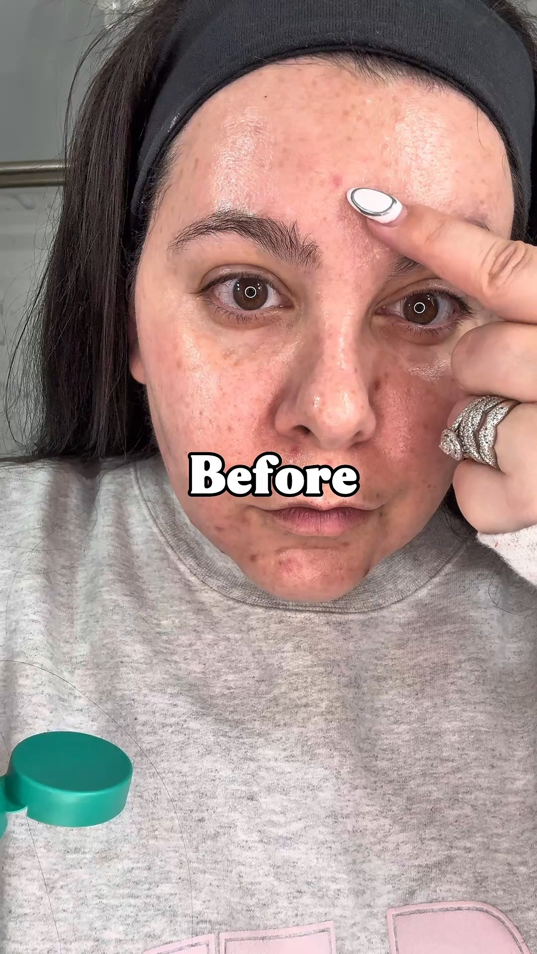 The Purito Panthenol Cream to help with acne marks and healing .

#LTKgrwm #LTKBeauty #LTKselfcare