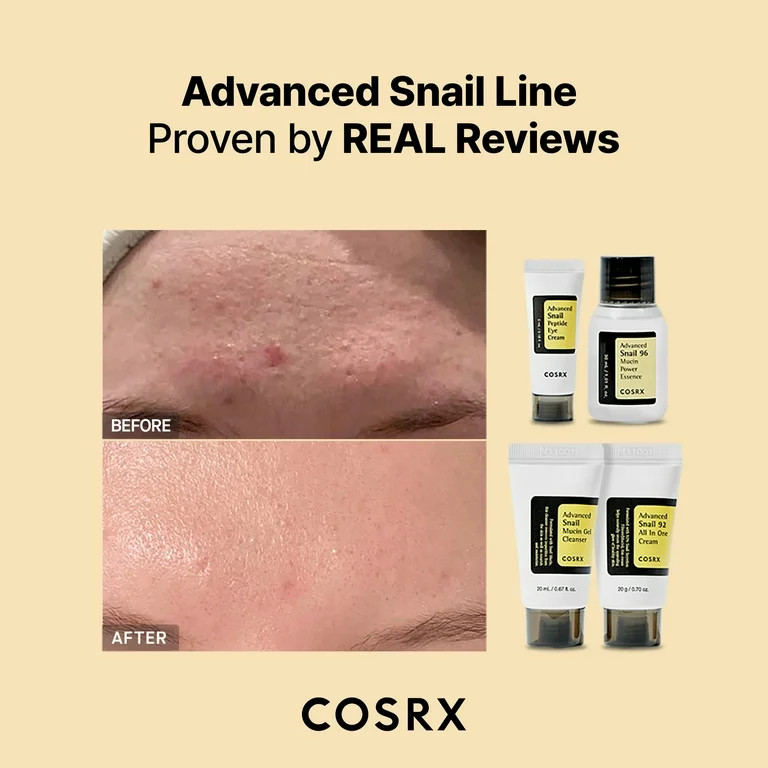 COSRX All About Snail Kit (4 Step) | Walmart (US)