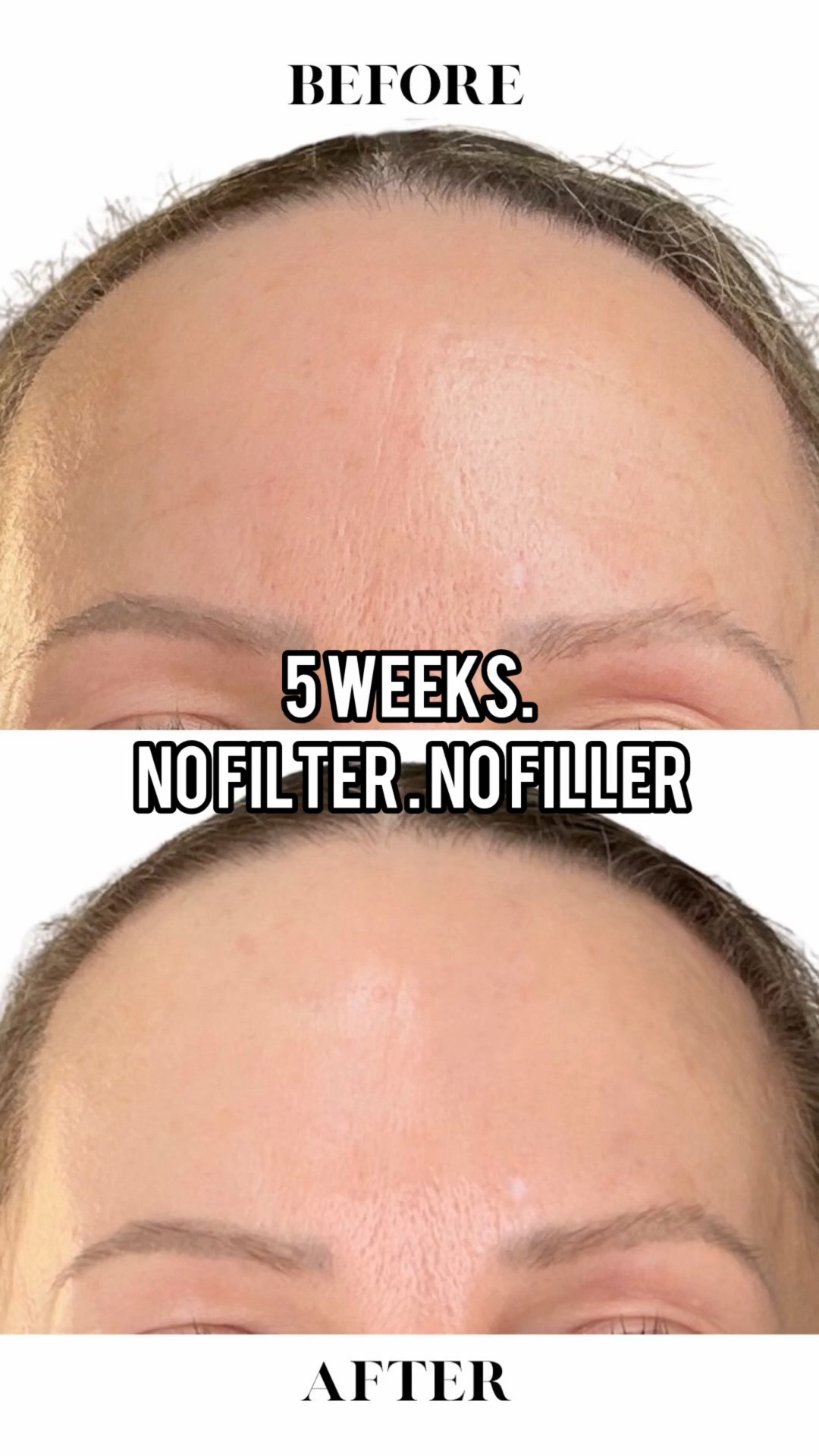 Dr Diamond’s Metacine results speak for themselves. Is it expensive? Yes, but it’s one of the few luxury skincare collections I’ve used that I’ve seen visible results from. @drdiamondsmetacine 

#LTKBeauty #LTKOver40