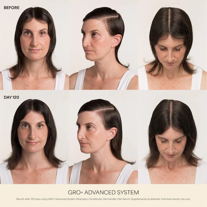 GRO+ Advanced Hair Serum for Severe Signs of Thinning | Sephora (US)