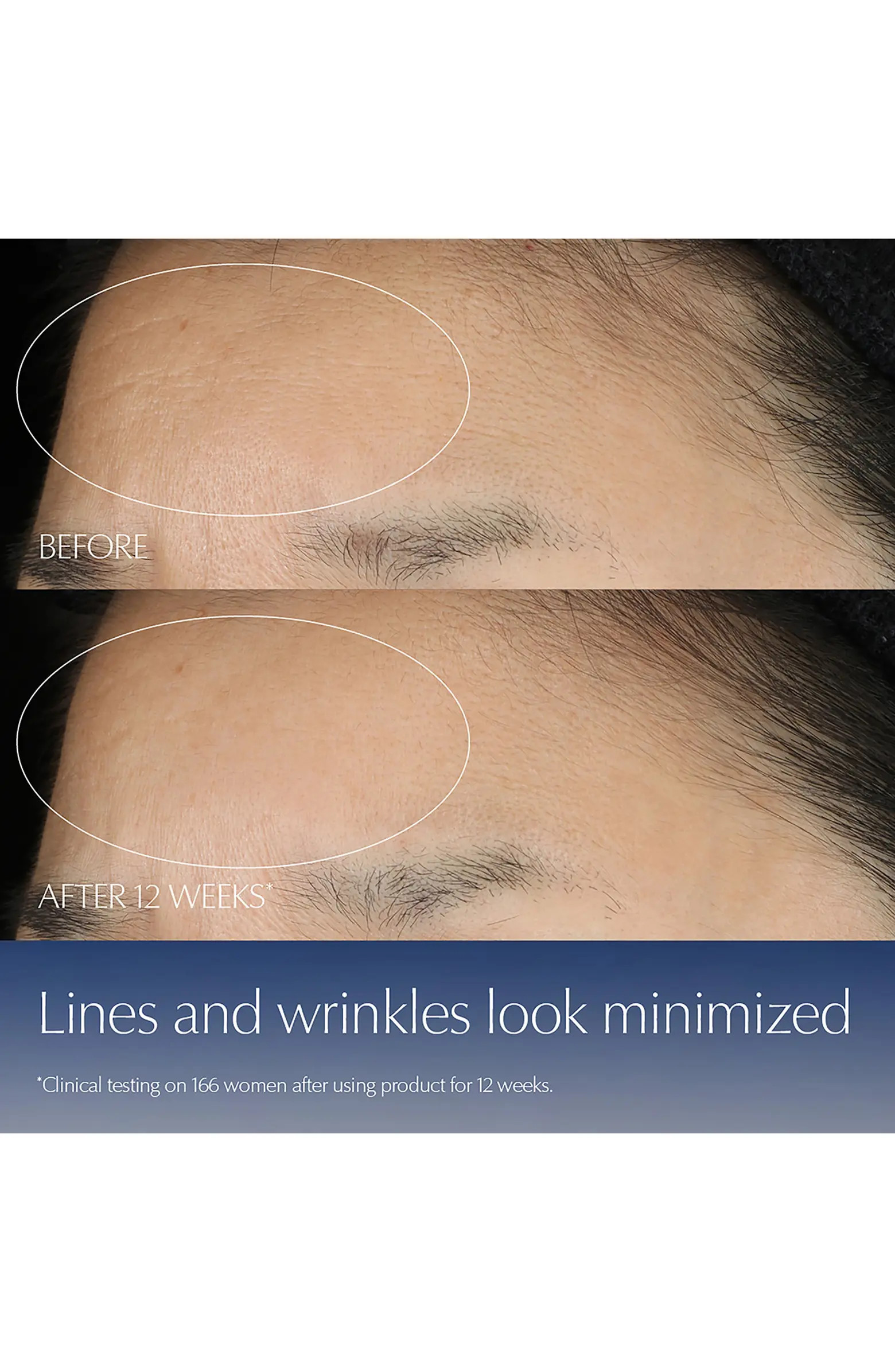 Jumbo Advanced Night Repair Synchronized Multi-Recovery Complex Serum with Hyaluronic Acid & Pept... | Nordstrom