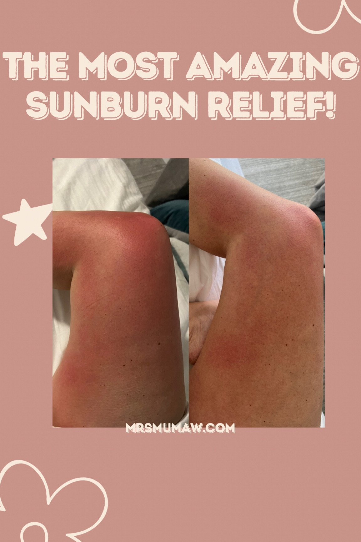 Never have I tried something that has soothed a sunburn this quickly! I put this on before bed and The redness starting going away after just 15-20 mins by morning was hardly there. 

#LTKTravel #LTKSwim #LTKBeauty
