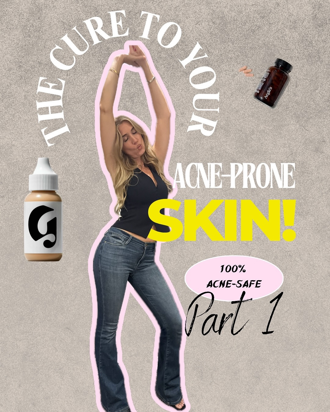 STOP Breaking Out! ❌🙅🏼‍♀️ The cure for acne-prone skin in my case was actually pretty simple, shame it took so many years to realise!

Follow @sorrell.forbes to get your clearest skin!✨

#acne #acneproneskin #noncomedogenic #acnesafe #health

#LTKbeauty