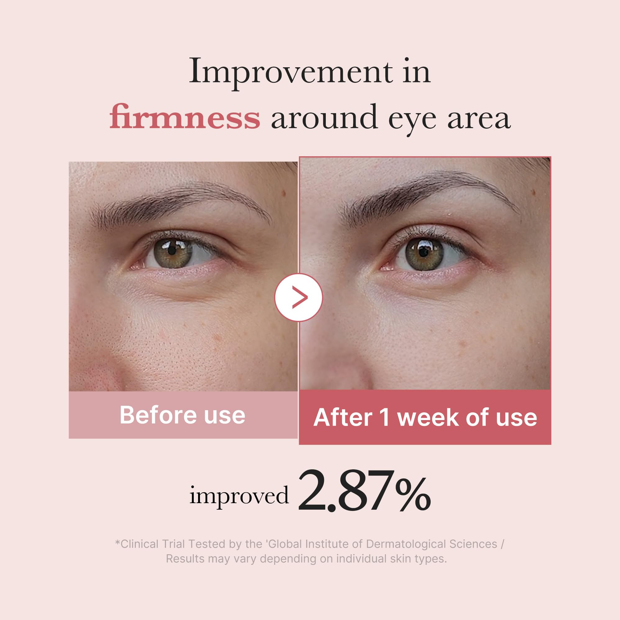 medicube Eye Serum with Salmon DNA PDRN & Pink Peptides | 99% Purity Retinol for Fine Lines | PDR... | Amazon (US)