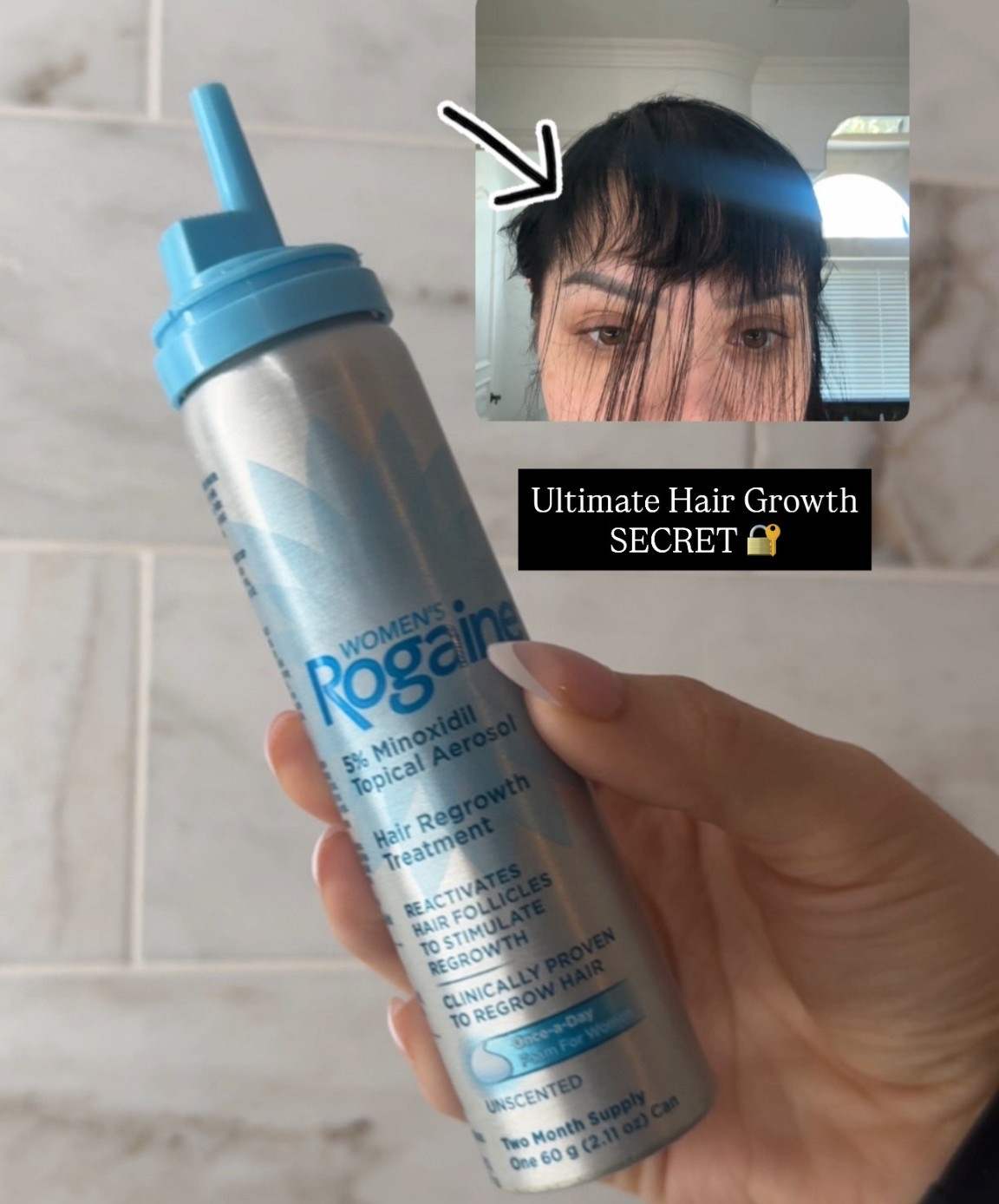 This was the secret to growing my hair back after hair loss. The regrowth is insane!

#LTKStyleTip #LTKBeauty #LTKFindsUnder50