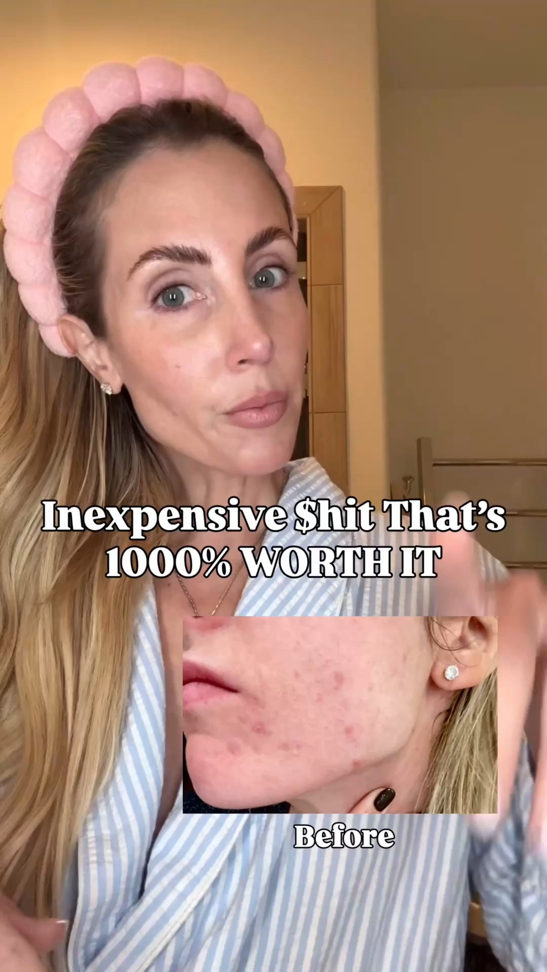 You will not regret this purchase !!

Skincare, skincare must haves, skincare finds, skincare routine, glass skin