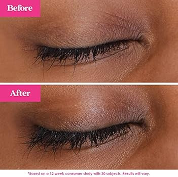 Grande Cosmetics GrandeLASH-MD Lash Enhancing Serum, Promotes Appearance of Longer, Thicker Eyela... | Amazon (US)