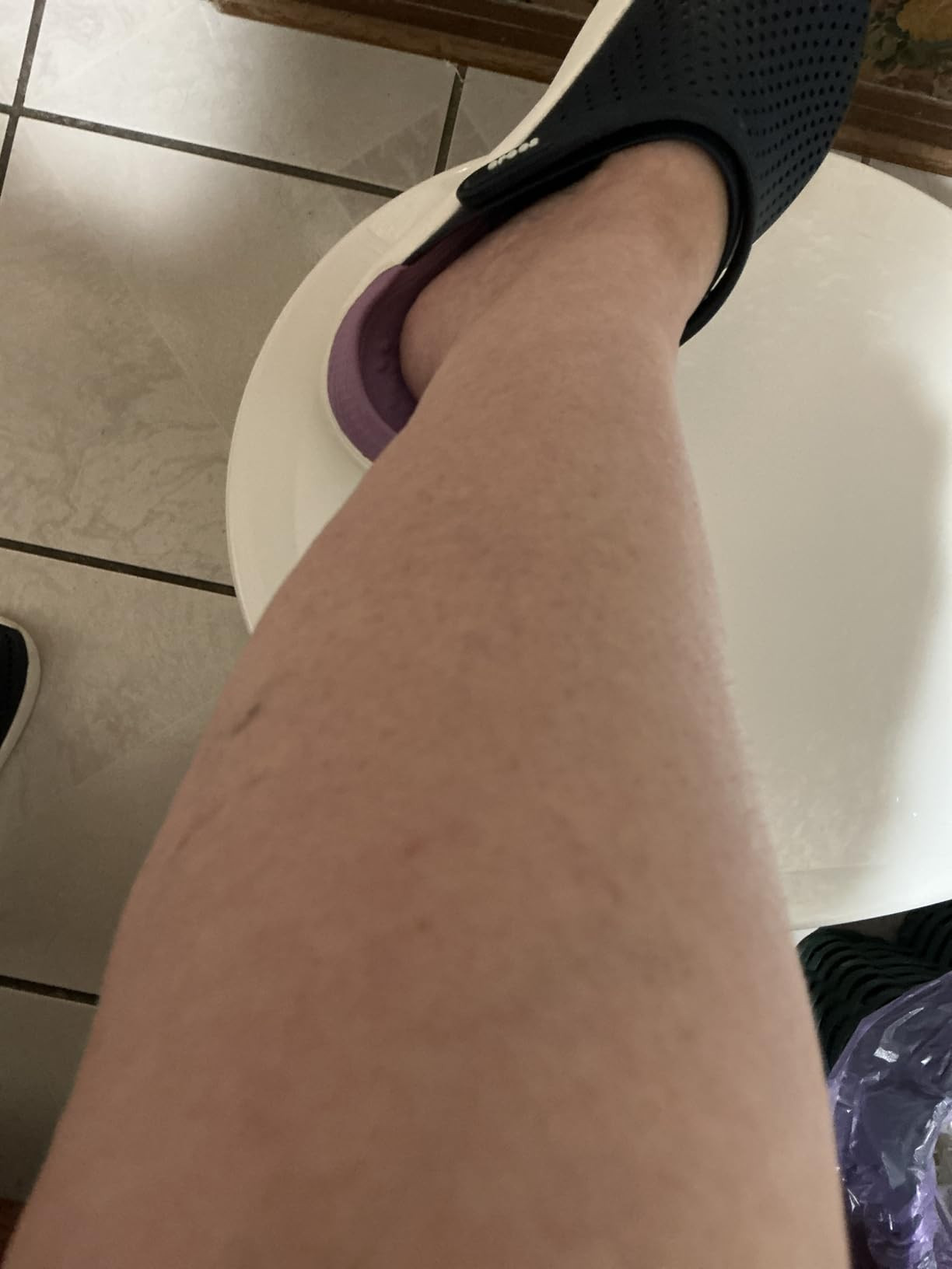 CHARMKING Compression Socks for Women & Men Circulation (3 Pairs) 15-20 mmHg is Best Support for ... | Amazon (US)