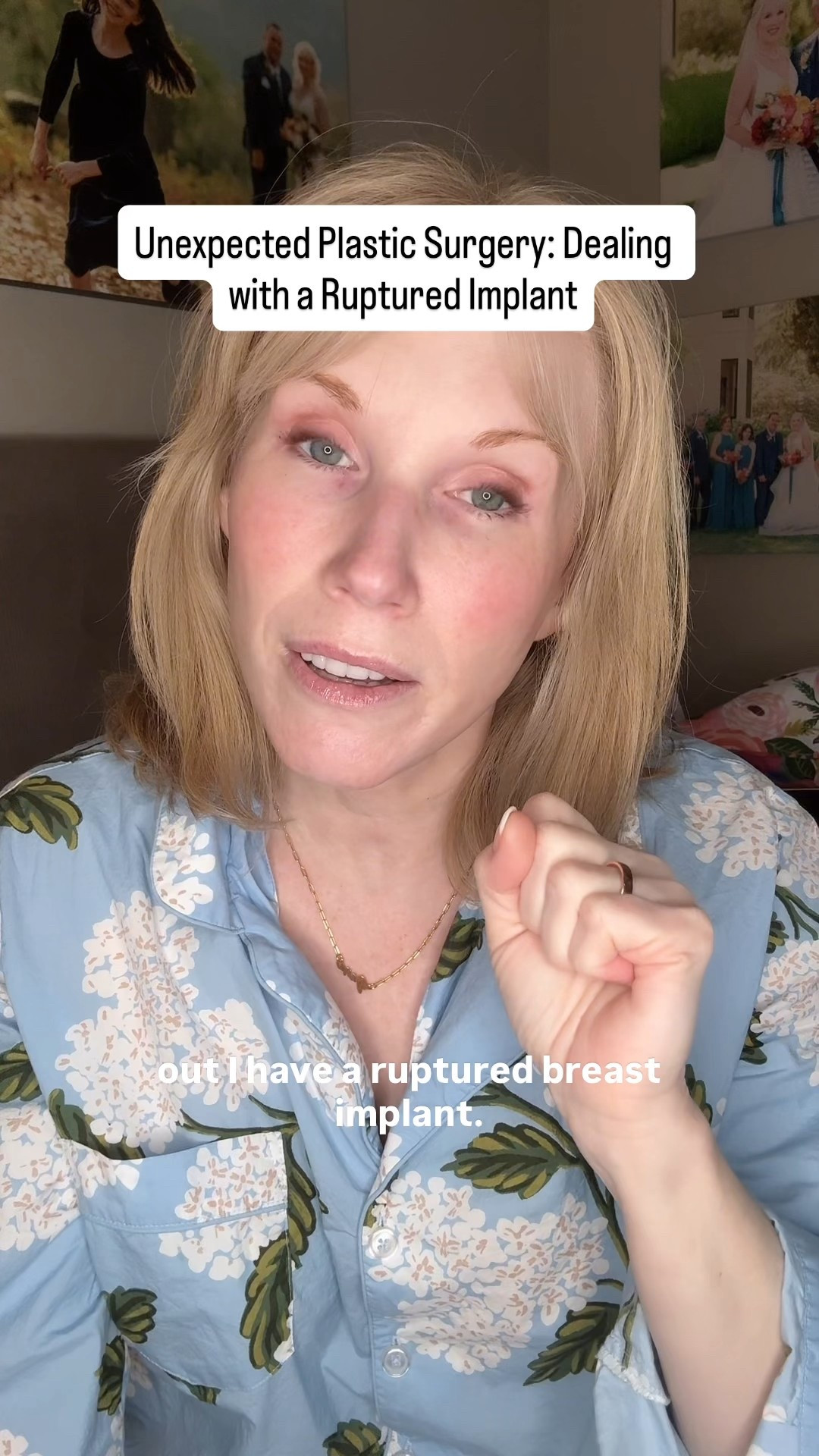 It’s back to another plastic surgery recovery and I will be with sporting my new pajamas!! 

#LTKMidsize #LTKOver40 #LTKStyleTip