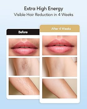 INNZA Laser Hair Removal with Ice Cooling Care Function for Women Permanent,999,999 Flashes Painl... | Amazon (US)