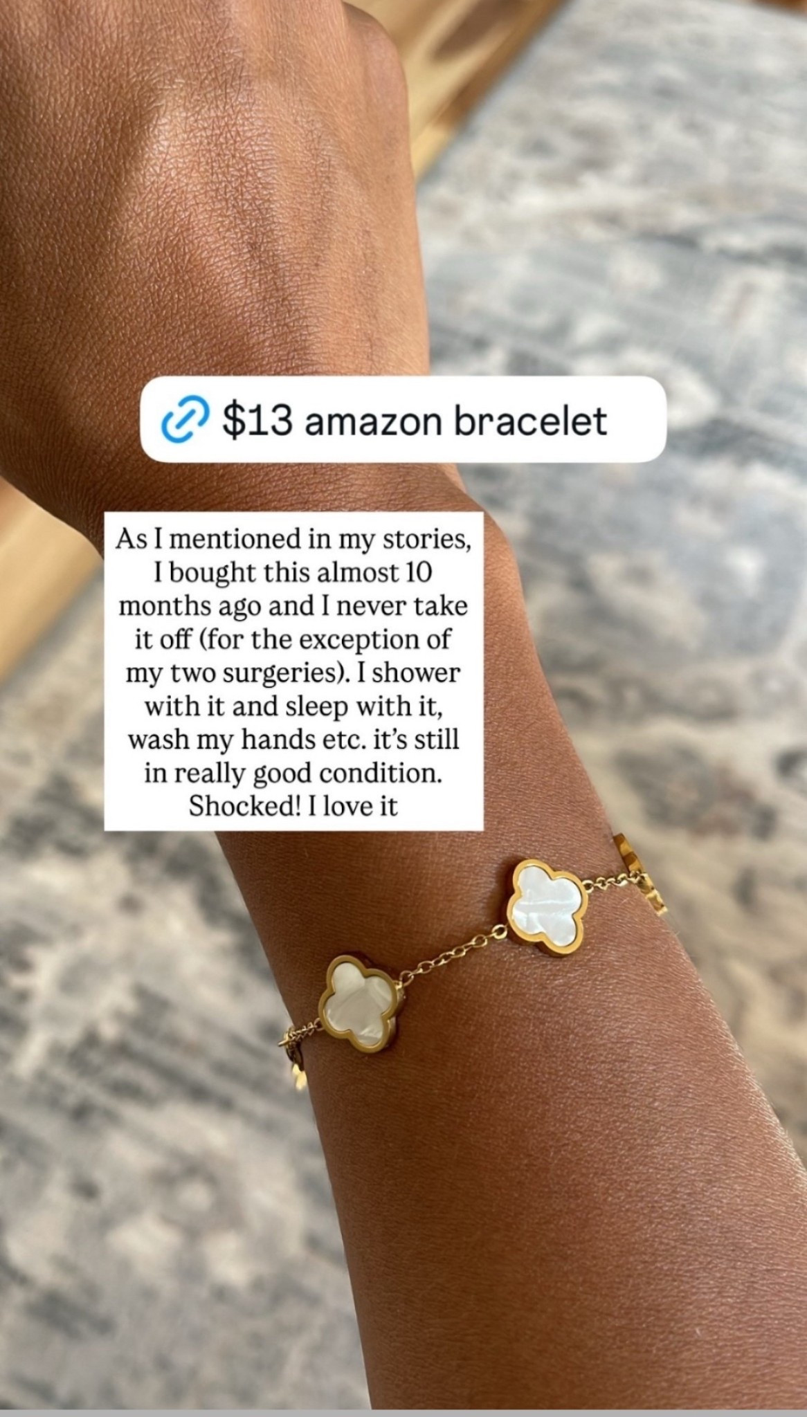 As I mentioned in my stories, I bought this almost 10 months ago and I never take it off (for the exception of my two surgeries). I shower with it and sleep with it, wash my hands etc. it’s still in really good condition. Shocked! I love it

