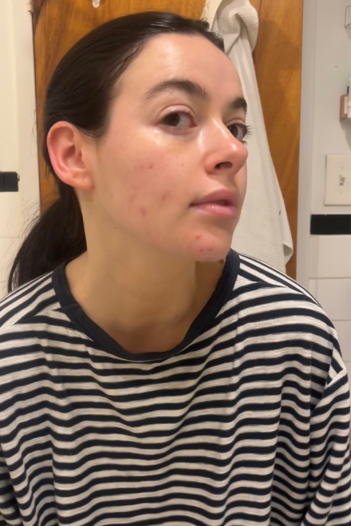 Morning skincare line up for sensitive skin

#LTKfindsunder100 #LTKfindsunder50 #LTKbeauty