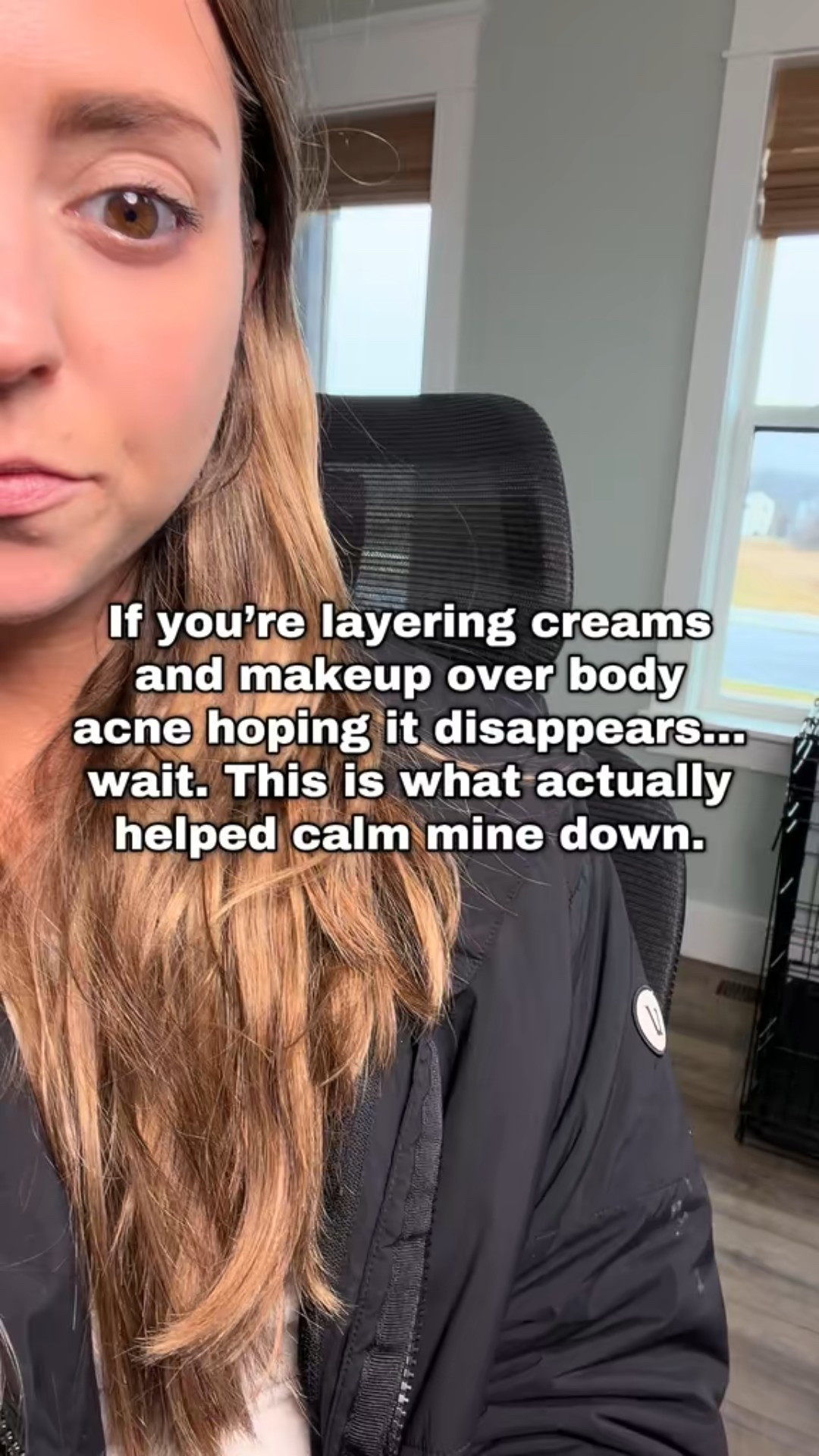 I thought body acne was just something I had to deal with... turns out I just needed a better routine. This combo made such a difference for my back breakouts 4*
#BodyAcne #BackAcneHelp #KoreanSkincare #AcneRoutine #MomLifeFinds

#LTKBeauty #LTKselfcare #LTKmorningroutine