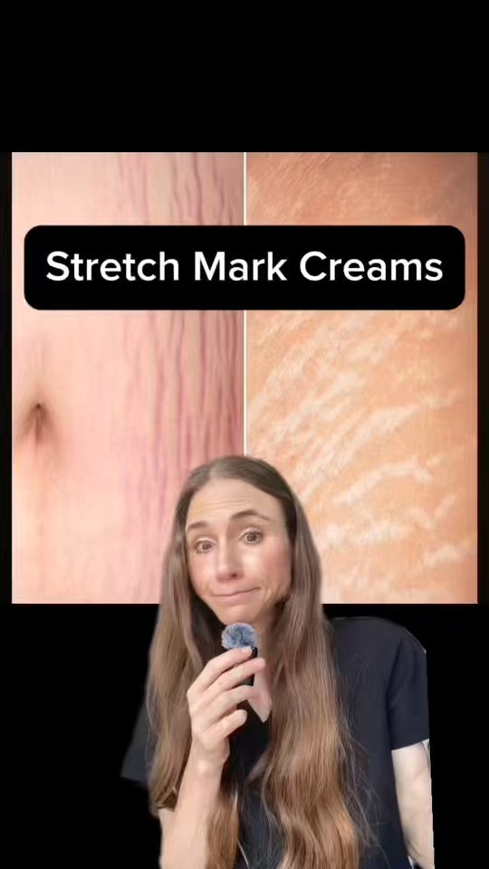 The truth about strech mark creams. #skincare 

 