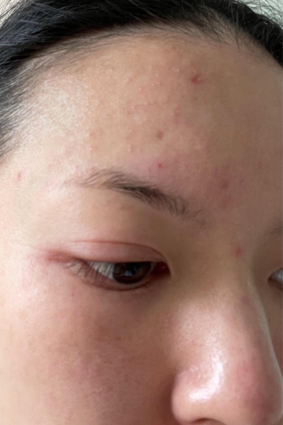 These are products I use when I am having an eczema flair up 😤 my skin starts reacting to everything but these never make me itchy/swollen - they actually soothe my skin and give me some relief! 