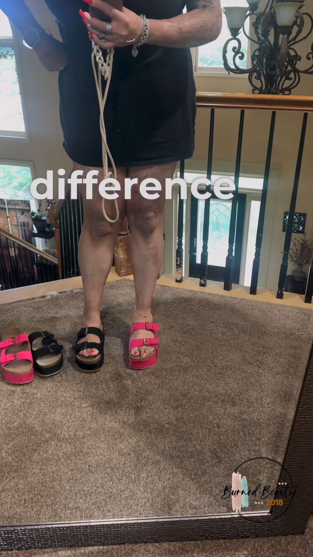 I’ve decided to keep both pairs because the black platform slide sandals - by another brand - are just so lightweight and comfortable - they’re just not as stylish as I wanted! I did measure them and they’re just under 2 inches heel to toe. I’ve been wearing them almost every day so they are still one of my favorites!

The pink pair is different though - very comfortable, and only slightly heavier, being made with a rubber sole, which feels more durable and does provide the 2 1/2 inch platform height.💖

slides, summer sandals, slide sandals, platform shoes, amazon prime day 

#LTKSummerSales #LTKVideo #LTKShoeCrush