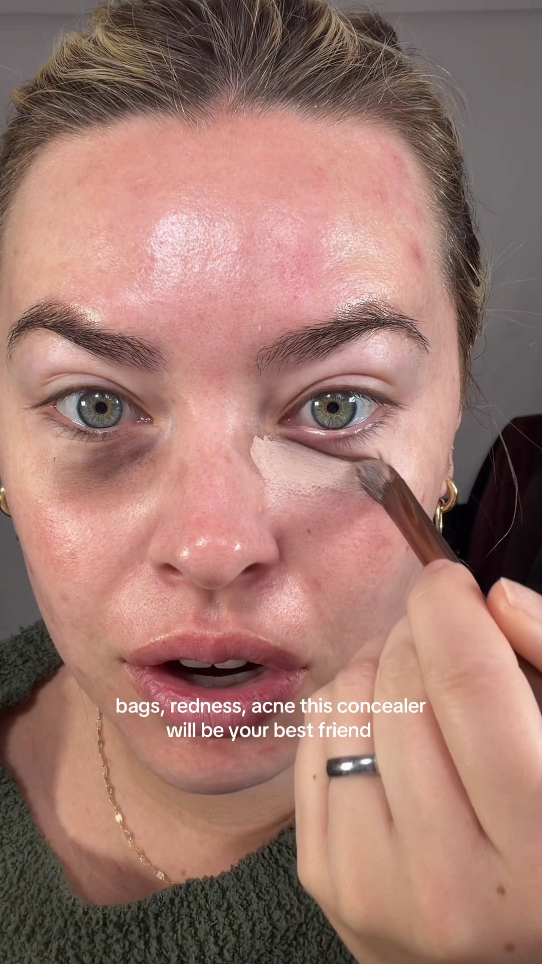 My favorite concealer for covering blemishes 

#LTKBeauty #LTKdayinmylife #LTKgrwm