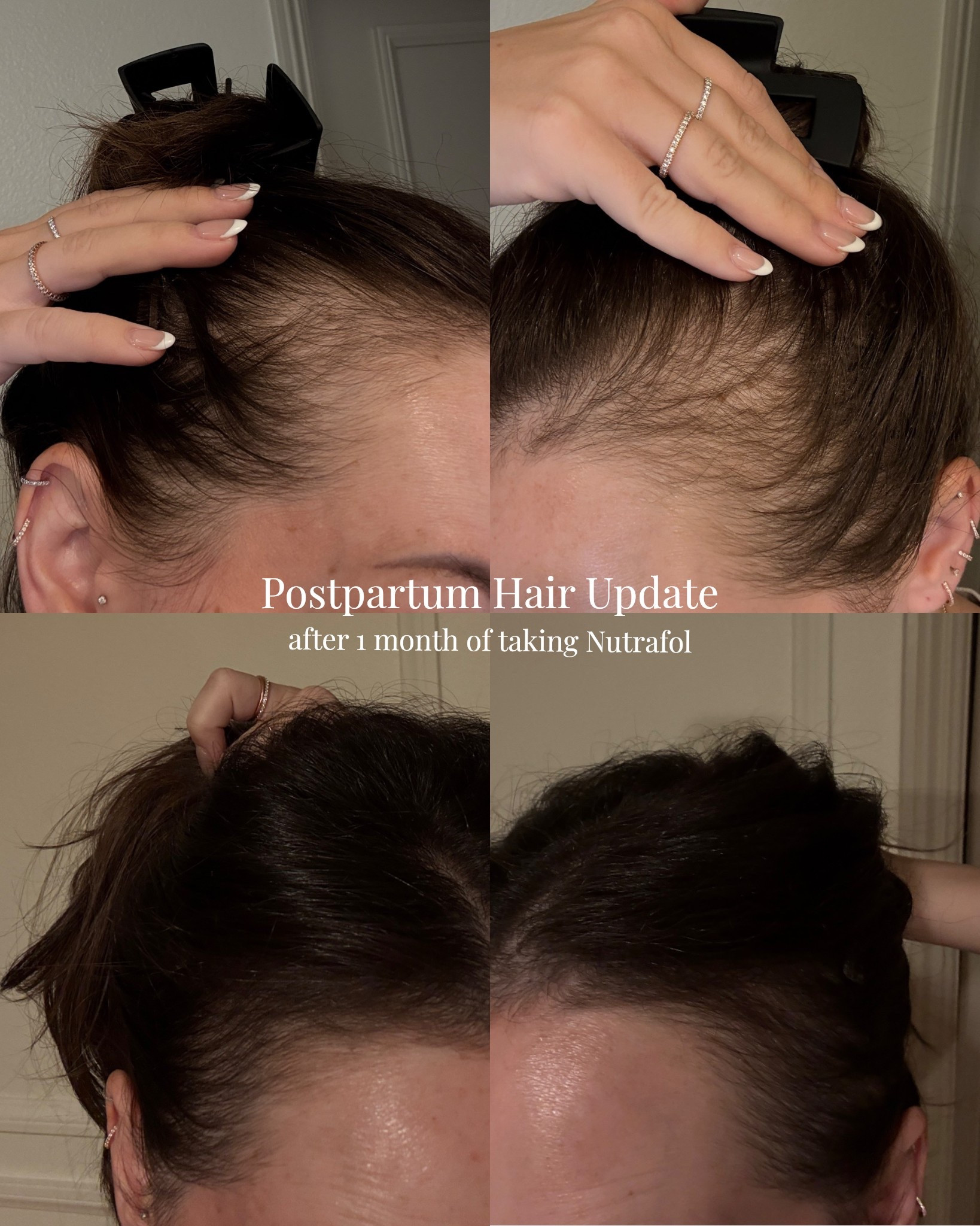 I swear by it!!!

Hair growth • hair vitamins • hair growth supplements • Nutrafol 


#LTKmomlife #LTKBeauty