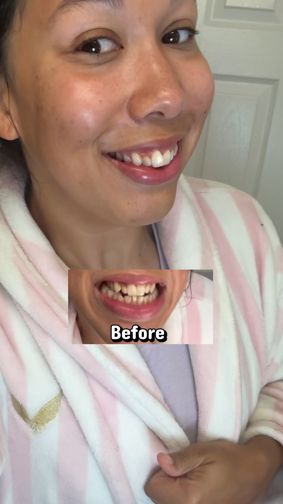 If your smile needs a quick glow-up, this is your sign 💜🦷
CeeLike Purple Teeth Whitener is officially in my daily routine. Link is on my LTK 🛍️✨
#whitesmile #teethwhitening #beautyhacks #selfcareessentials #ltkfinds #viralbeauty #smileglowup

#LTKmomlife #LTKselfcare #LTKBeauty