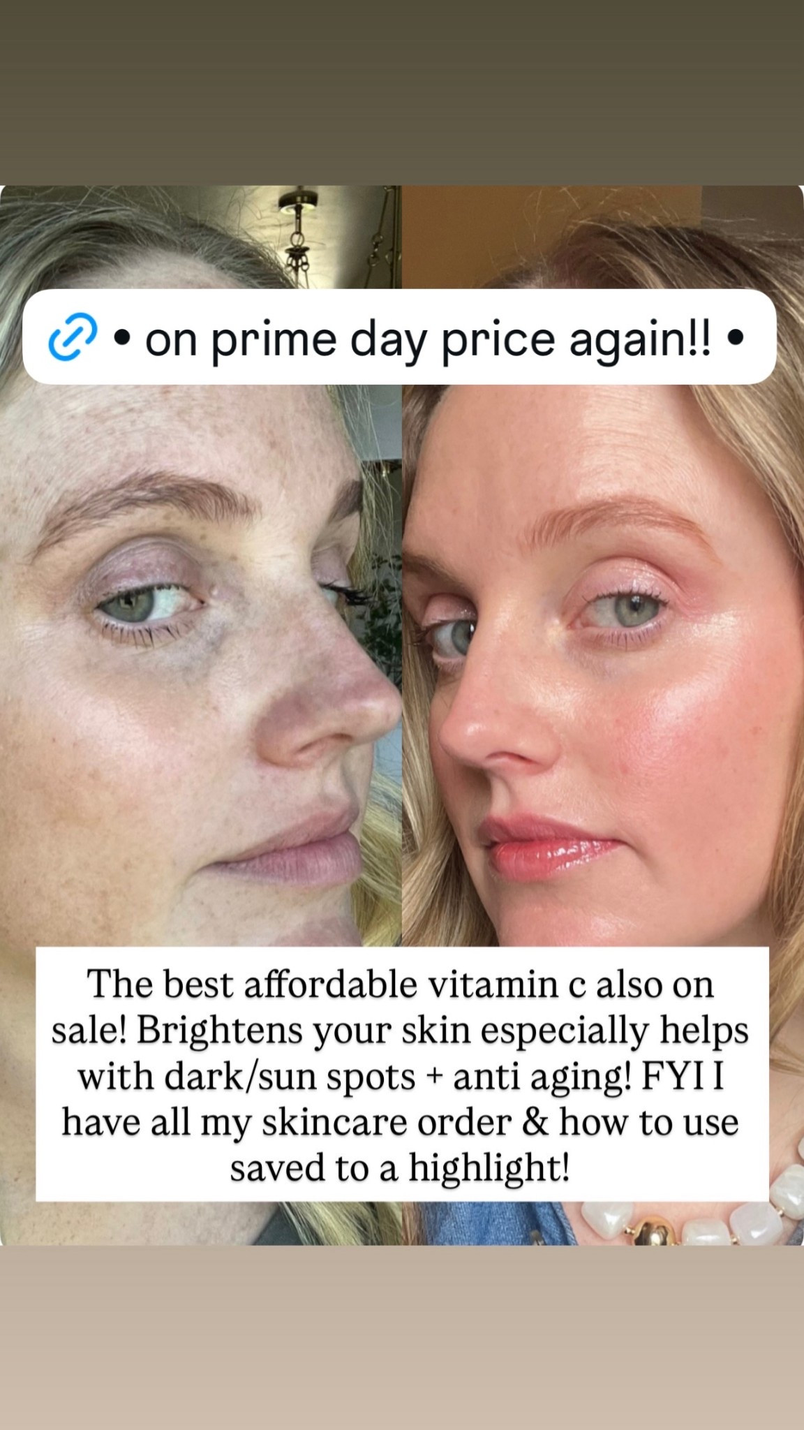 The best vitamin C Serum! On prime day price again!

#LTKmomlife #LTKBeauty #LTKselfcare