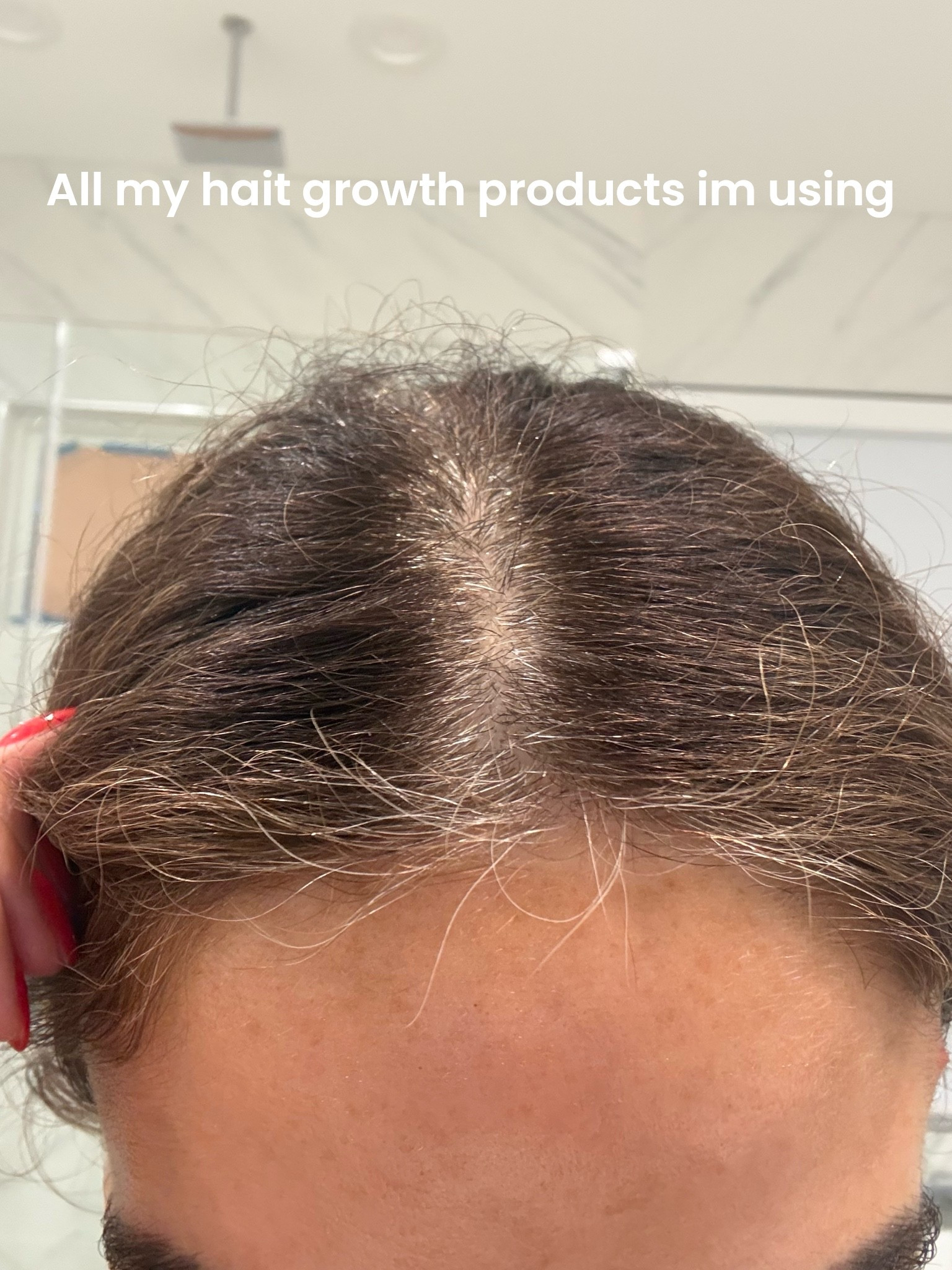 All of the hair growth products I’m using that have actually worked

#LTKBeauty