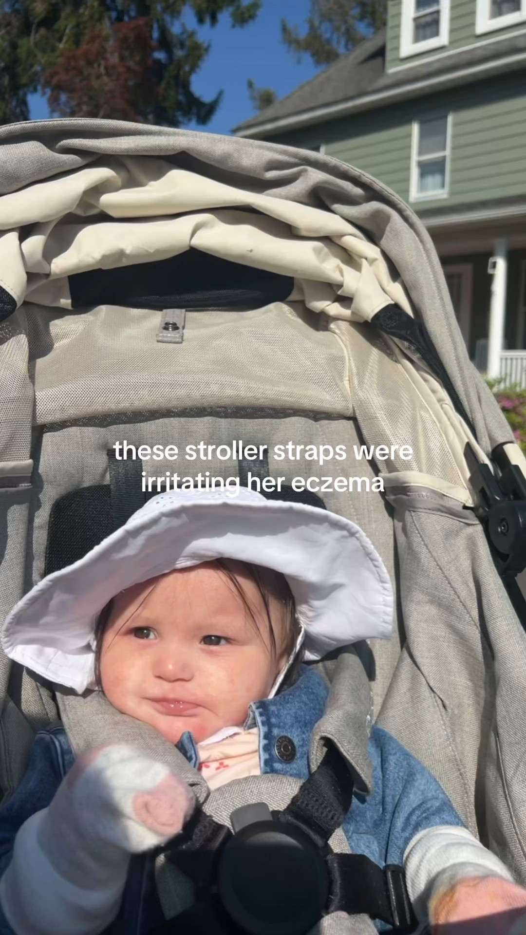 the small wins of our baby eczema journey!

#LTKKids #LTKBaby #LTKFamily