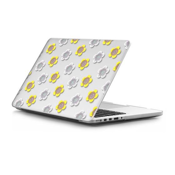 Macbook Case - Yellow and white daisy flowers clear | Casetify