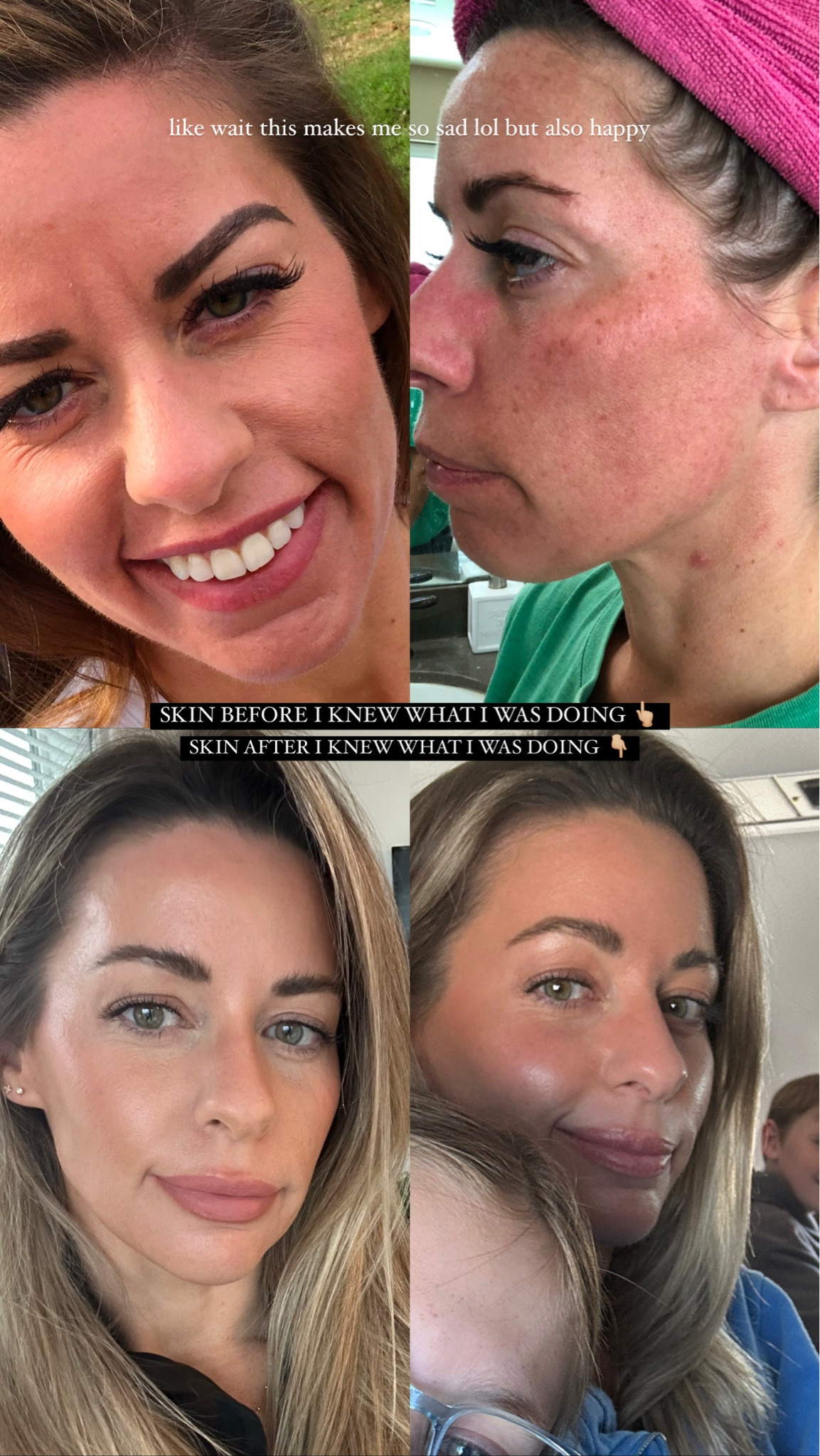 Full routine linked on IG! 

#skincare #ltkskin

#LTKBeauty