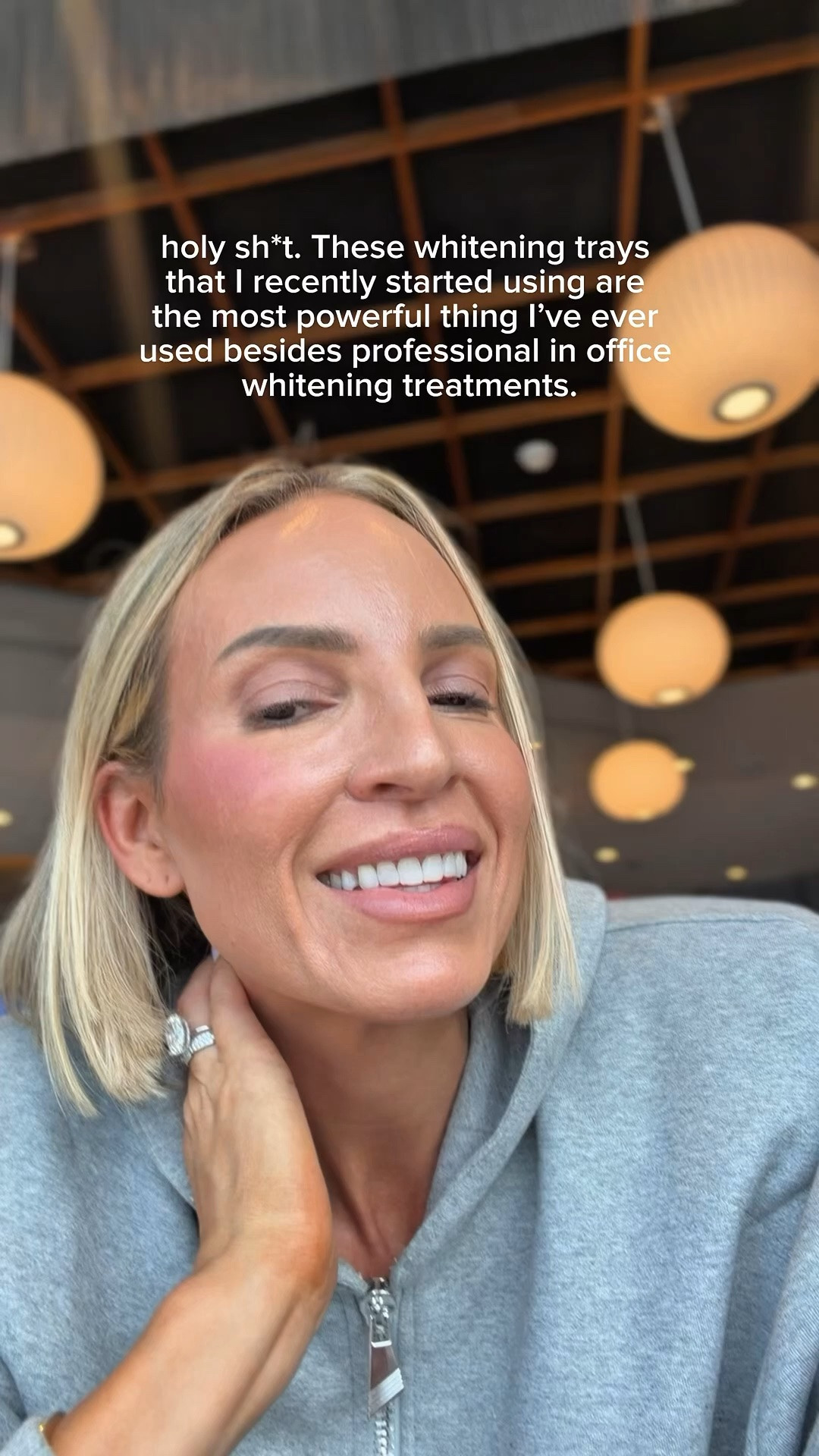 These whitening trays are POWERFUL

#LTKTravel #LTKdayinmylife #LTKBeauty
