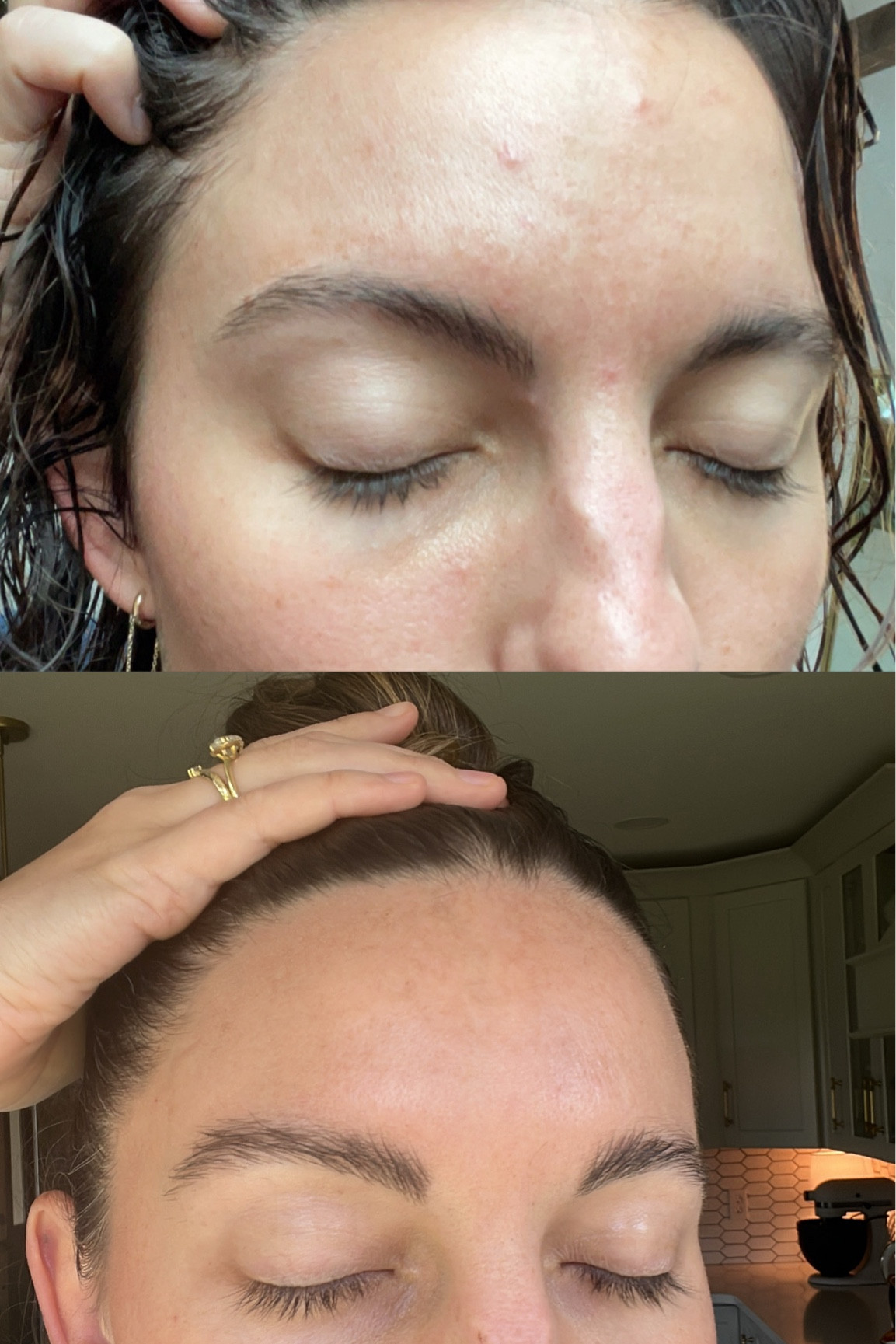 The TWO holy grail products that changed my skin. 

#LTKSaleAlert