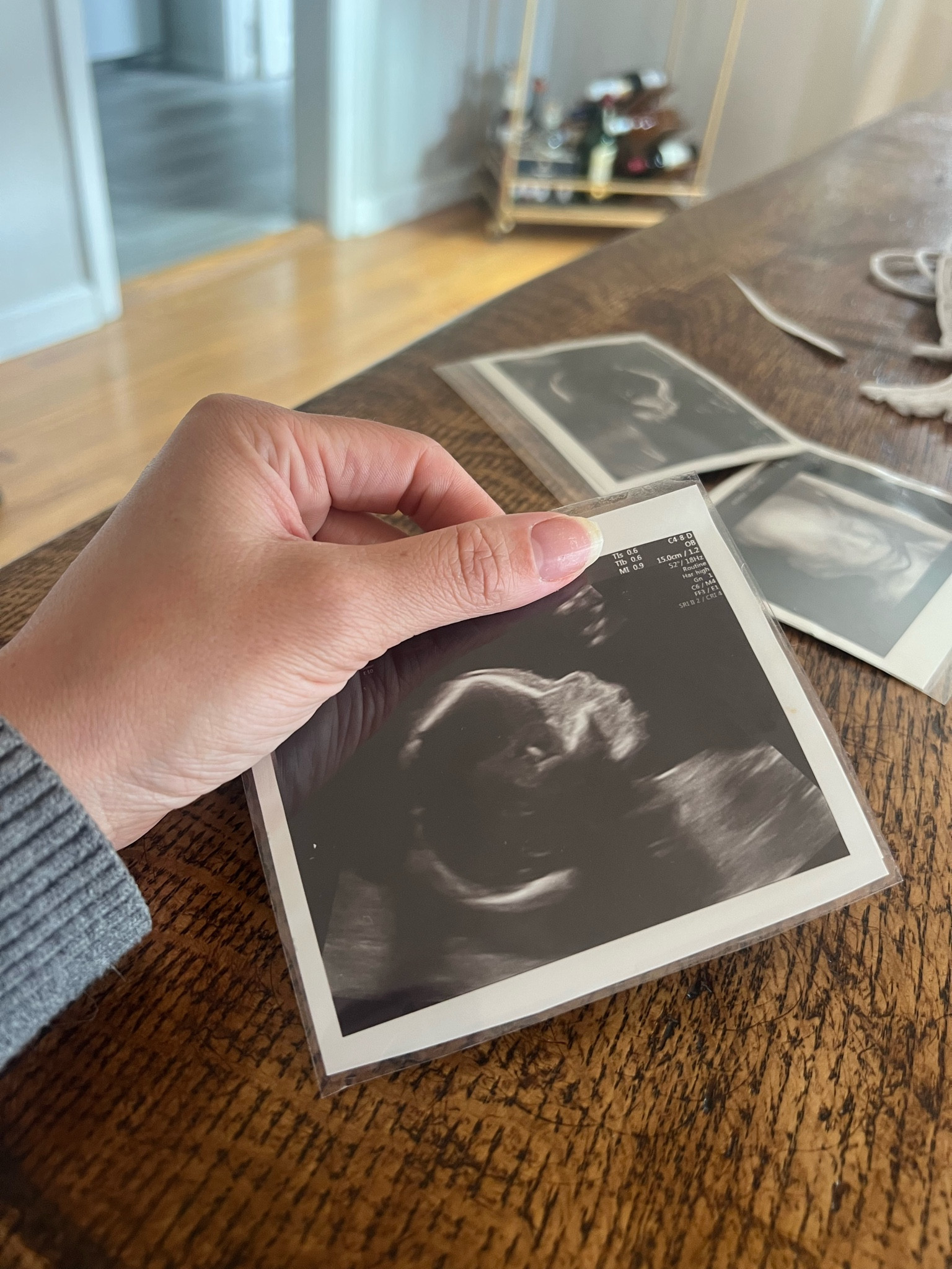 Mother’s Day gift idea for grandmas. Mom to be. Ultrasound picture. Laminate ultrasound picture. Pregnancy journal. Amazon finds. 

#LTKbaby #LTKbump #LTKfamily