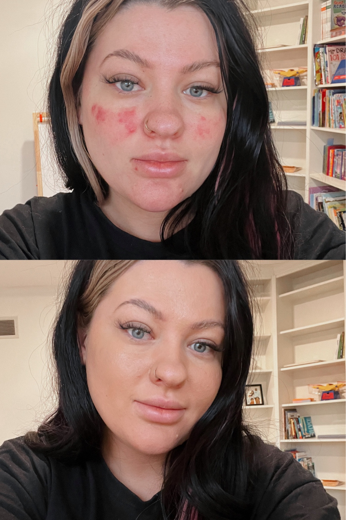 the best foundation for redness coverage!