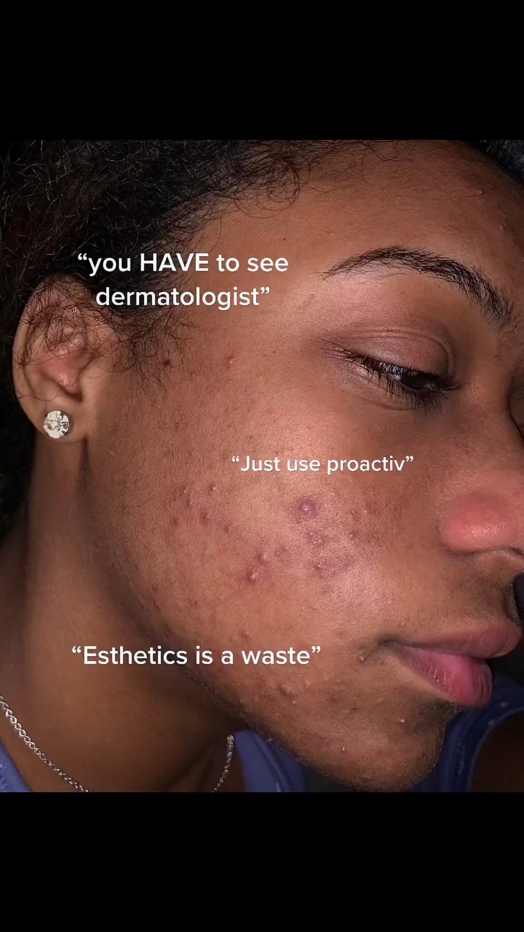 shoutout to chemical peels & esthetics school! 🥳 #greenscreen #greenscreenvideo