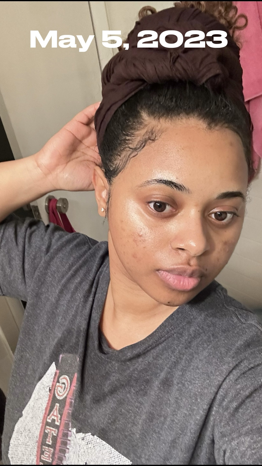 Products I used for my hormonal acne and scarring. It’s not totally cleared but I will continue providing updates  

#LTKFind #LTKbeauty