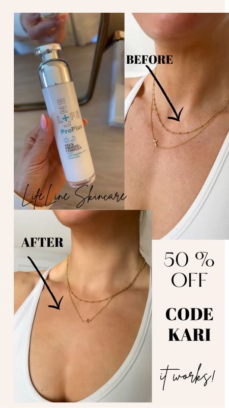 Save 50% with code Kari.  It’s remarkable!  #ad I wish I would have discovered this product years ago!  Made with stem cells that reduce skin discoloration and redness for a more uniform tone, lessens the visibility of fine lines and creases, stimulates collagen production and promotes cell renewal for rejuvenated skin!  I can wait to check out the entire Lifeline skincare regimen because it works!  @lifelineskincare #lifelineskincare


#LTKbeauty #LTKfindsunder50 #LTKsalealert
