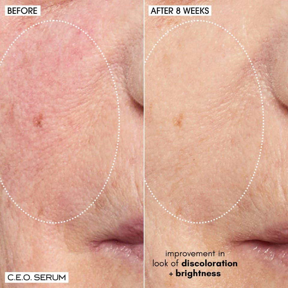 Radiant, even-toned skin starts here ✨
This vitamin C serum instantly boosts glow and helps fade dark spots over time — lightweight, fast-absorbing, and the perfect step under makeup or moisturizer.

Up to 20% off right now with code EVERYTHING — ends 11/10.

#LTKBeauty #LTKSaleAlert #BeautyDeals #SkincareFavorites #GlowingSkin #BrighteningSerum #EverydaySkincare #HerAvenueFinds 

 #LTKGiftGuide #LTKSaleAlert #LTKBeauty