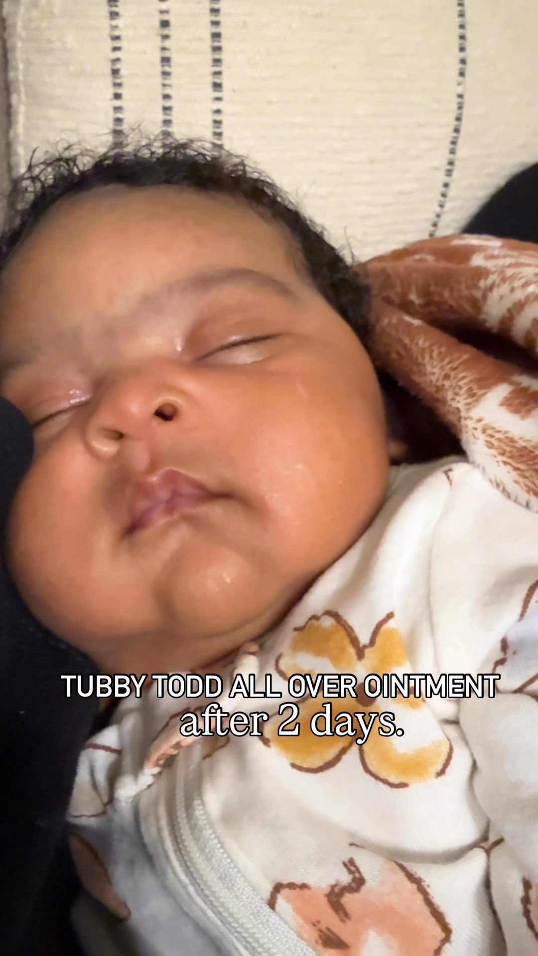 Newborn must-have! This Tubby Todd AOO (All Over Ointment) helped me ease that newborn acne within 2 days

#LTKKids #LTKBaby #LTKFamily