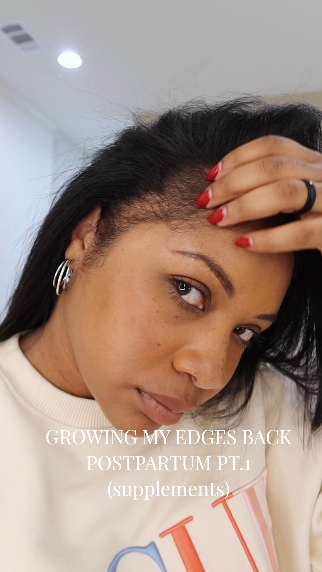 The supplements that are helping me grow my hair back after pp hair loss🙌🏾

#LTKBaby #LTKmomlife #LTKselfcare