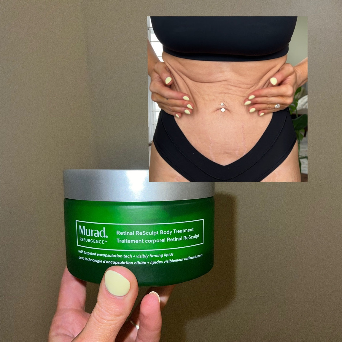 My favorite body treatment for loose skin post weight loss 🧴