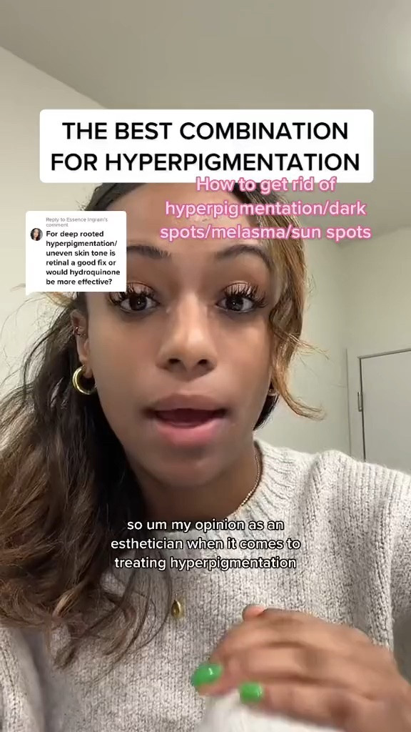 How to get rid of dark spots/acne marks/hyperpigmentation/melasma/sun spots: you need a COMBINATION treatment. Something that will increase cell turnover, remove top layers of pigmented cells and inhibit melanogenesis. You can do this using retinol, chemical exfoliants and tyrosinase inhinitors (the most powerful being hydroquinone). I have a list of product recommendations linked in my bio! #esthetician  #hyperpigmentation #hyperpigmentationtreatment