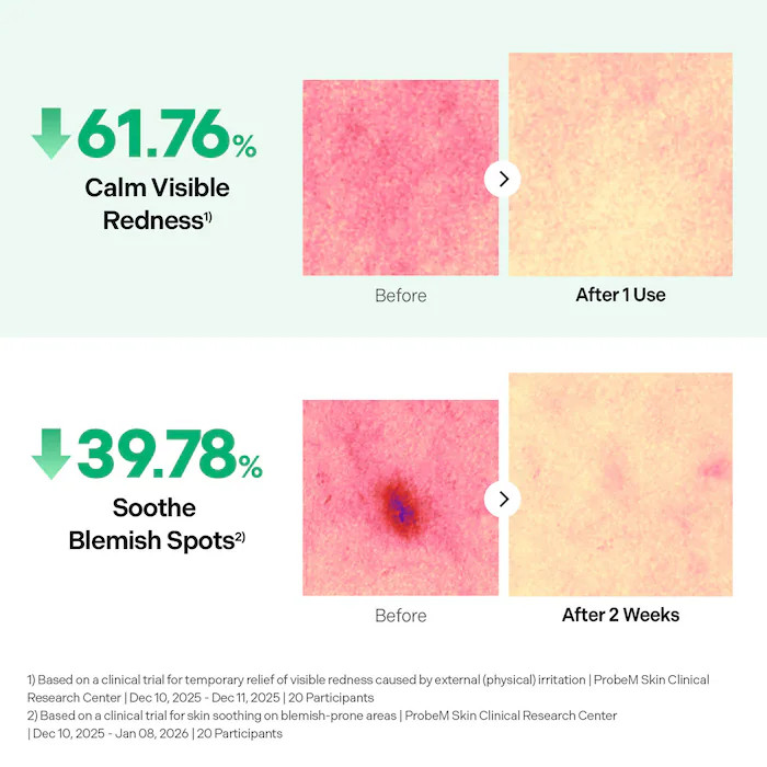 Torriden BALANCEFUL Azelaic Acid Blemish Serum for Redness & Spot Relief | Sephora (US)